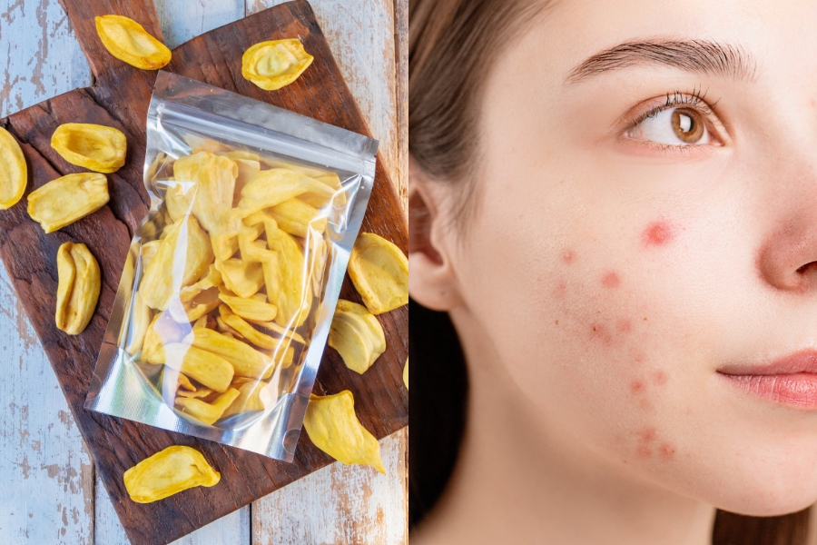Điều gì xảy ra khi ăn quá nhiều mít sấy?
